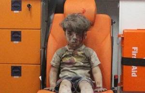 Brother of Syrian boy pictured in Aleppo dies of his wounds